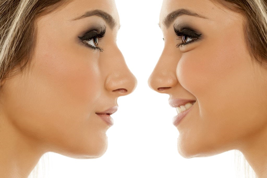 جراحی زیبایی بینی؛ تاریخ را با عنوان دیگری تکرار کنید
