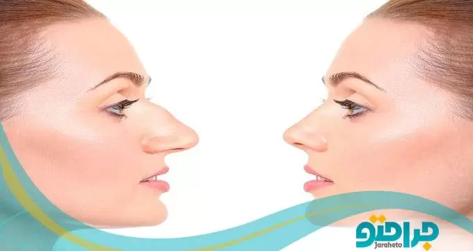 جراحی جراحی | گوشت