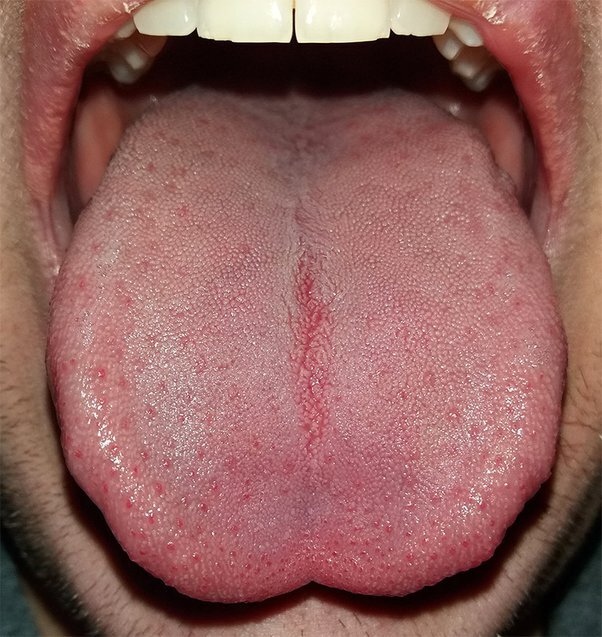 تاثیر منحصر به فرد زبان روی لذت بردن از غذا