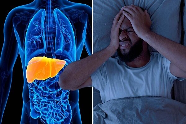 اصفهان مرکز مطالعات کبد چرب در کشور است - خبرگزاری مهر | اخبار ایران و جهان