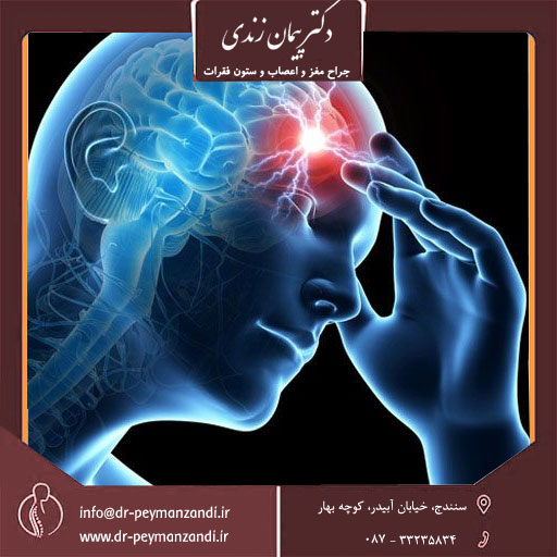 سردرد
