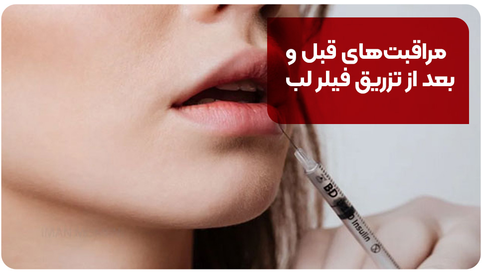 مراقبت